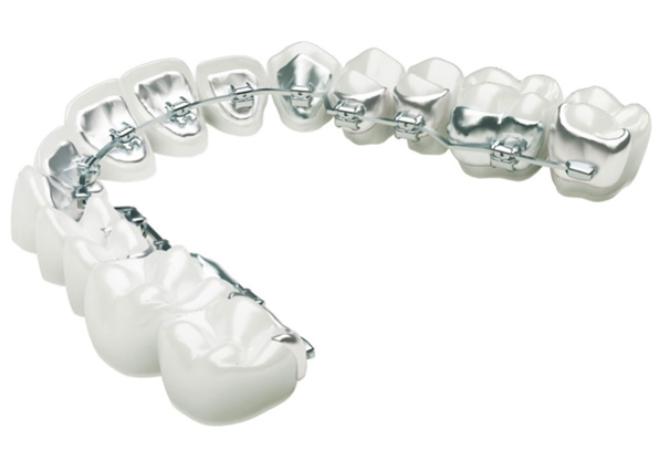 Orthodontiste adulte Lyon 4 Croix-Rousse - Cabinet des Dr Bertrand Godet & Gabriel Lietz